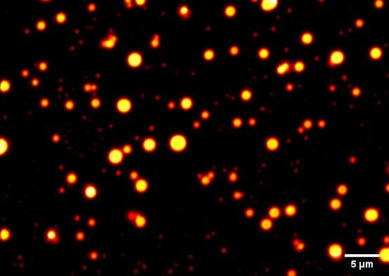 Researchers have found that RNA molecules can undergo phase separation in a temperature-dependent manner, and this phase behavior is supported by magnesium ions in solution. Here, CAG-repeat RNA droplets are shown in a physiologically relevant buffer. (Image courtesy of Gable Wadsworth and Priya Banerjee)