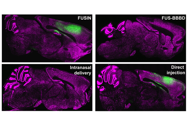 In new research, Hong Chen and her team developed an intranasally delivered gene therapy method that had comparable or better outcomes than existing methods while having minimal effect on the body’s other organs. (Chen lab)  