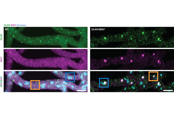 Fungal cells expressing RNA molecules CLN3 and BNI1 asynchronously form non-overlapping "demixed" condensates (left column) whereas cells expressing these RNAs synchronously form mixed condensates. (Credit: Pappu lab)