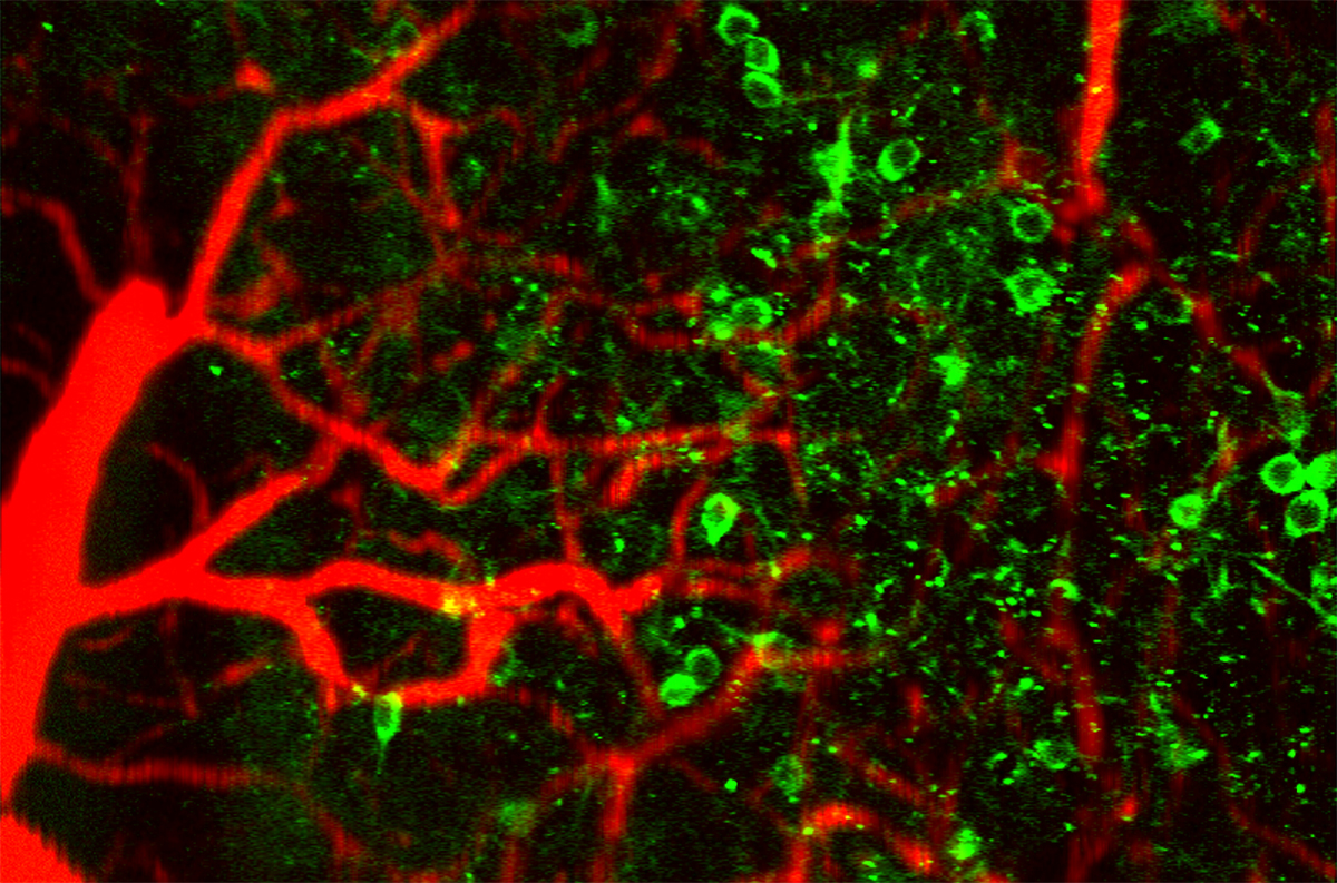 The image shows neuronal calcium activity (green) and vascular hemoglobin concentration (red). A new microscopy technique developed at WashU can show how the brain’s red blood cells deliver oxygen to its neurons, a tool that could better enable research on stroke and dementia. (Credit: Song Hu/WashU)