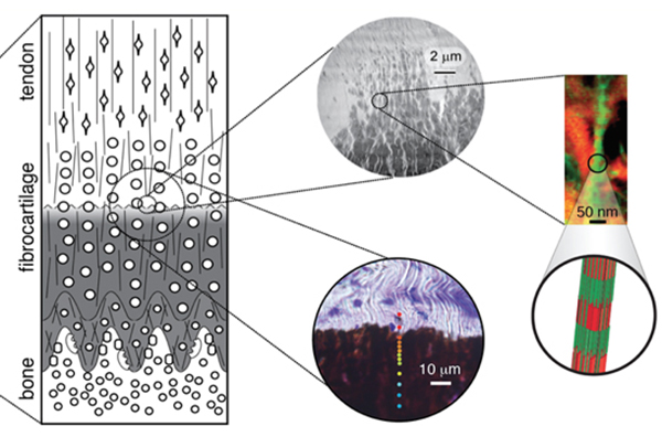 At the tissue level, the enthesis appears as a smoothly graded tissue. However, disorder appears at the micro- and nano-scales. Genin GM and Thomopoulos S, 2017. The tendon-to-bone attachment: Unification through disarray. Nature Materials, 16(6), pp.607-608.