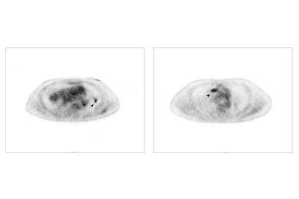  In one of Jha’s approaches for evaluating the realism of synthetic images, a synthetic image and a real image are presented side by side via an online platform. For each image pair, the reader is asked to identify the image that they perceive as real. (Jha lab)