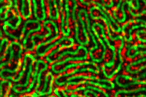 Super-resolution microscopy is revealing unprecedented insight into the protein structures that underlie the stability and function of the kidney filtration system. The new grant to the Miner, Genin and Suleiman labs will transform these insights into potential targets for the treatment of kidney disease. (Photo credit: Dr. Pongpratch Puapatanakul, MD, laboratory of Jeff Miner)