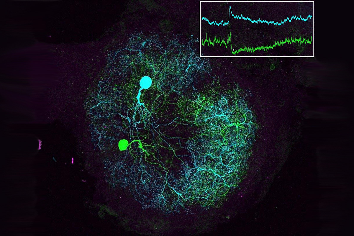 Histological images of depolarizing and hyperpolarizing local neurons that modulate the overall activity of the antennal lobe neural network that processes sensory input from the insect antenna. (Credit: Raman lab) 
