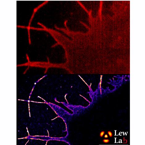 Top: conventional fluorescence microscopy; bottom: single-molecule nanoscopy