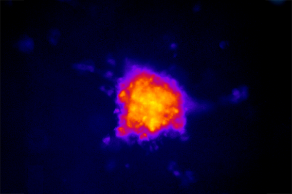 Fluorescent image showing increased expression of a hypoxia marker (Image-iT red hypoxia) in breast cancer spheroids (BT549, triple-negative breast cancer cells) after exposure to hypoxia, followed by normoxia, within 3D collagen matrices. Scale bar, 500 μm. (Credit: José Almeida, Pathak lab)
