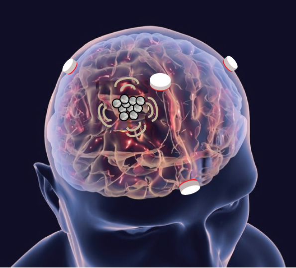 Hong Chen and her team are developing tiny sensors to detect blast-induced traumatic brain injury with new funding from the Office of Naval Research. (Credit: Chen lab)