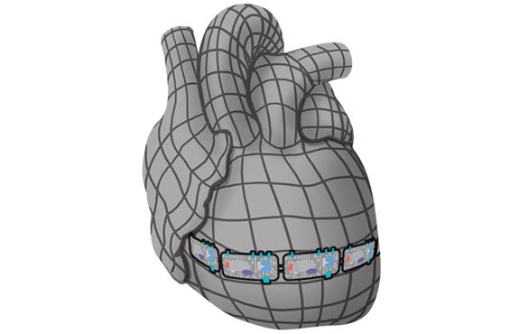 Jon Silva and his team used data from two long QT syndrome mutations to make a model that fit a range of electrophysiologic and structural data specific to each mutation. Credit: Moreno, J.D. et al. J Am Coll Cardiol Basic Trans Science. 2019;4(6):736–51.