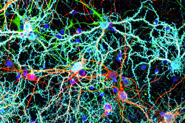 In a new NSF-funded study, Barani Raman and Srikanth Singamaneni aim to understand the fundamental mechanisms behind interactions between neurons and nanoparticles.
