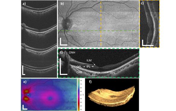 A volumetric render of the retina from a healthy volunteer acquired using the SDM-OCT instrument. Wide-field 3D images covering a 12.5 mm×7.4 mm region were acquired in less than 1 second.  