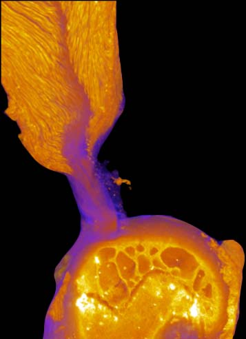 Mercury (II) chloride-stained contrast enhanced high-resolution microCT imaging revealed that, hidden within the well-known larger apparent attachment footprint area, is a smaller, much denser primary insertion site where tendon fibers insert directly into the bone. This image is a 3D volume rendering of representative intact enthesis. (Courtesy Genin Lab)