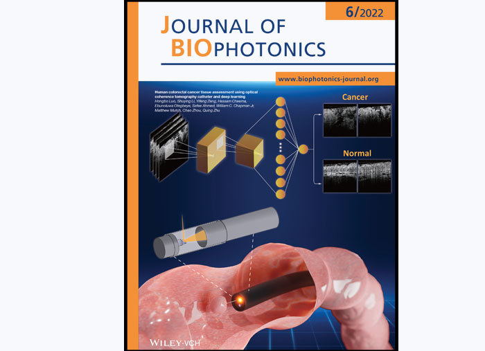 QuingZhuJournal-of-Biophotonics-RECORD.jpg