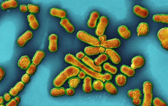 Influenza particles (artificially coloured) swap the proteins on their surfaces with ease. Credit: Eye of Science/SPL