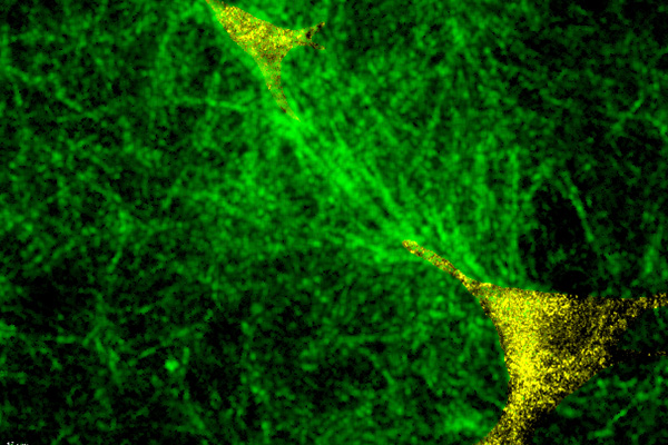 Washington University researchers have shown discovered why cells communicate mechanically through the extracellular matrix, but only within a critical distance of approximately 100-200 micrometers. When cells are close enough, their contractile forces recruit and align collagen fibers into stiffened "tension bands" (visible as aligned fibers between cells) that transmit mechanical signals between neighbors, while cells beyond this threshold (right pair) remain mechanically isolated despite being in the same tissue. This distance-dependent mechanical communication drives a sharp phase transition where tissues switch from disordered to coordinated states, explaining why fibrotic diseases often progress in abrupt jumps. Scale bar 10 micrometers. (Credit: Wenyu Kong, Tsinghua University)