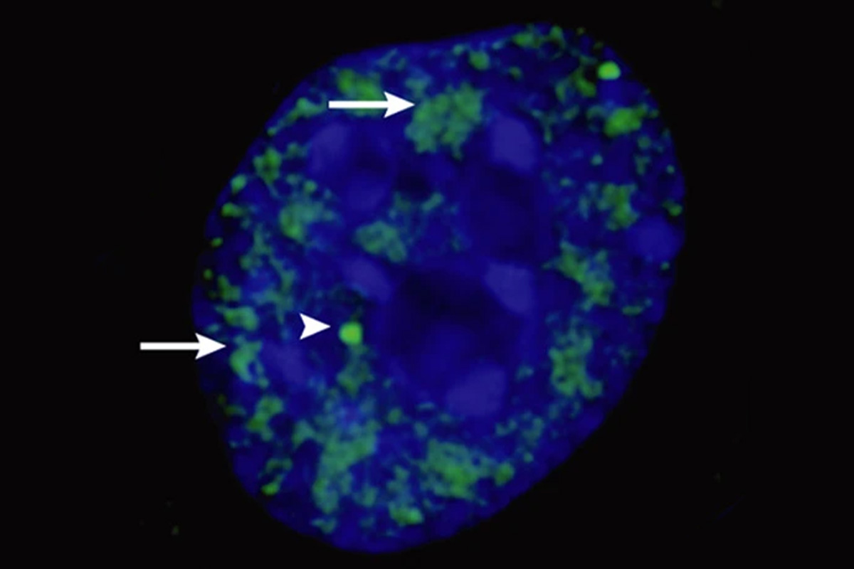 Rohit V. Pappu, the Gene K. Beare Distinguished Professor of Biomedical Engineering, and Min Kyung Shinn, a former postdoctoral researcher in his lab, investigated some of the physical features of nuclear speckles that were inconsistent with the type of uniform droplets one expected to see if they formed via liquid-liquid phase separation. Their microscopy images revealed that the speckle-associated proteins were distinct in the types of structures they formed. [Credit: Nature Reviews Molecular Cell Biology 4, 605–612 (2003).]